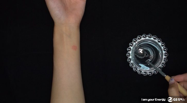 모기 물렸을 때, 간지러움 없애기