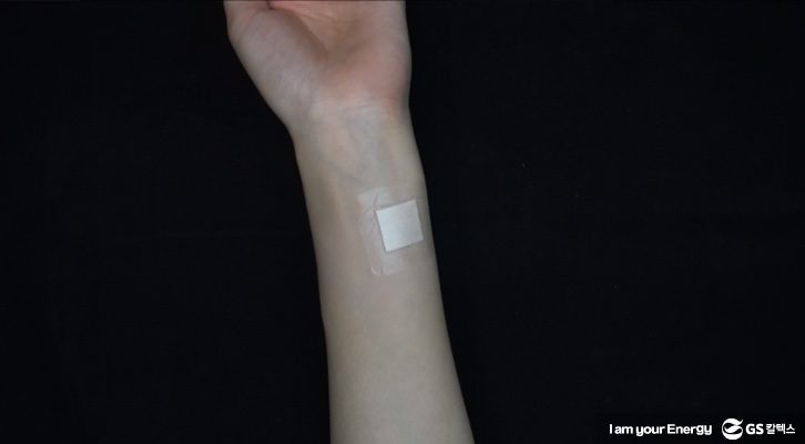 모기 물렸을 때, 간지러움 없애기, 반창고 붙이기